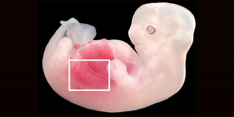 Брак органів у минулому. Китайські вчені виростили людську нирку в ембріоні свині